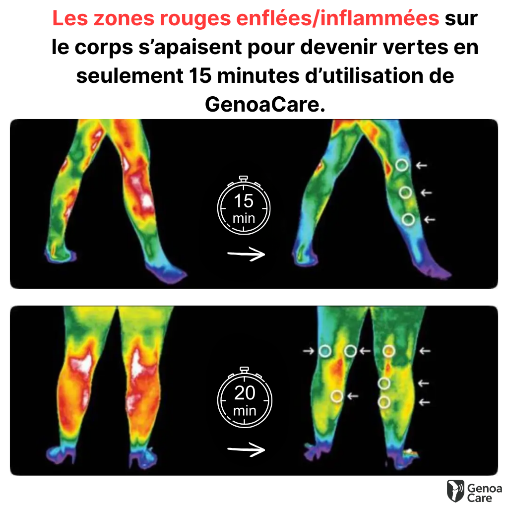 GenoaCare - Soulage les douleurs d'arthrose