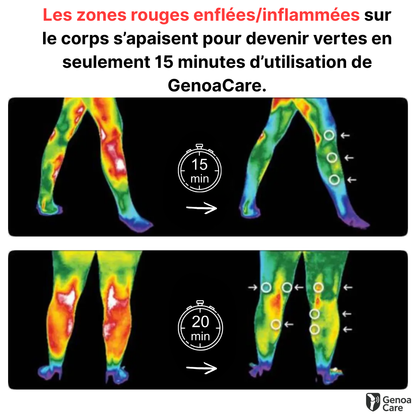 GenoaCare - Soulage les douleurs d'arthrose